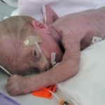 Toby through his incubator window